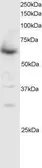 Anti-SMAD4 antibody, C-term used in Western Blot (WB). GTX89968