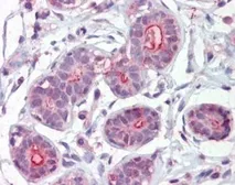 Anti-DAP Kinase 2 antibody, C-term used in IHC (Paraffin sections) (IHC-P). GTX89970