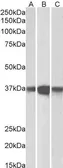 Anti-PP2A alpha + PP2A beta antibody, C-term used in Western Blot (WB). GTX89984