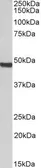 Anti-ORC4L antibody, C-term used in Western Blot (WB). GTX89991